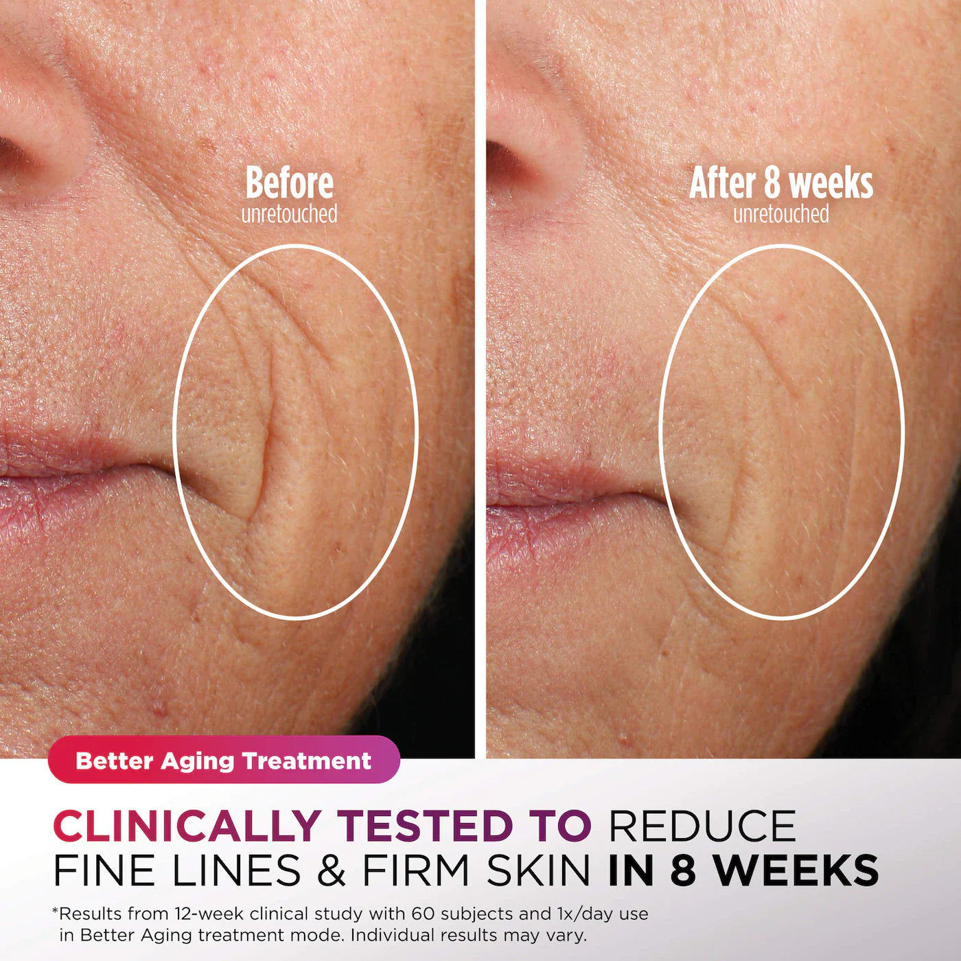 CryoGlow Cooling + LED Face Mask & Facial Glo Skin Tool